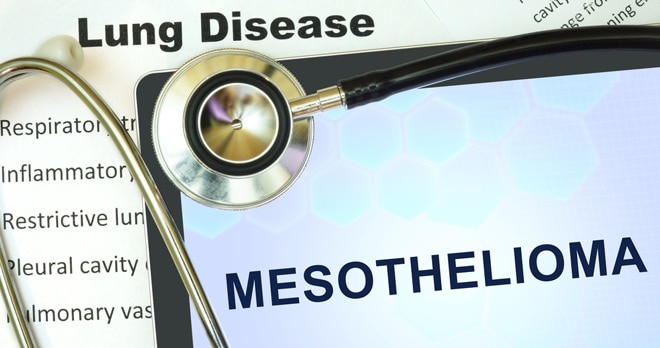 Mesothelioma