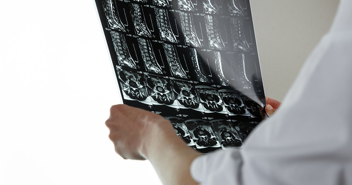 Doctor inspecting a set of spinal scans
